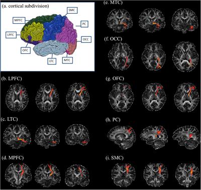 Thalamic Structural Connectivity Abnormalities in Minimal Hepatic Encephalopathy